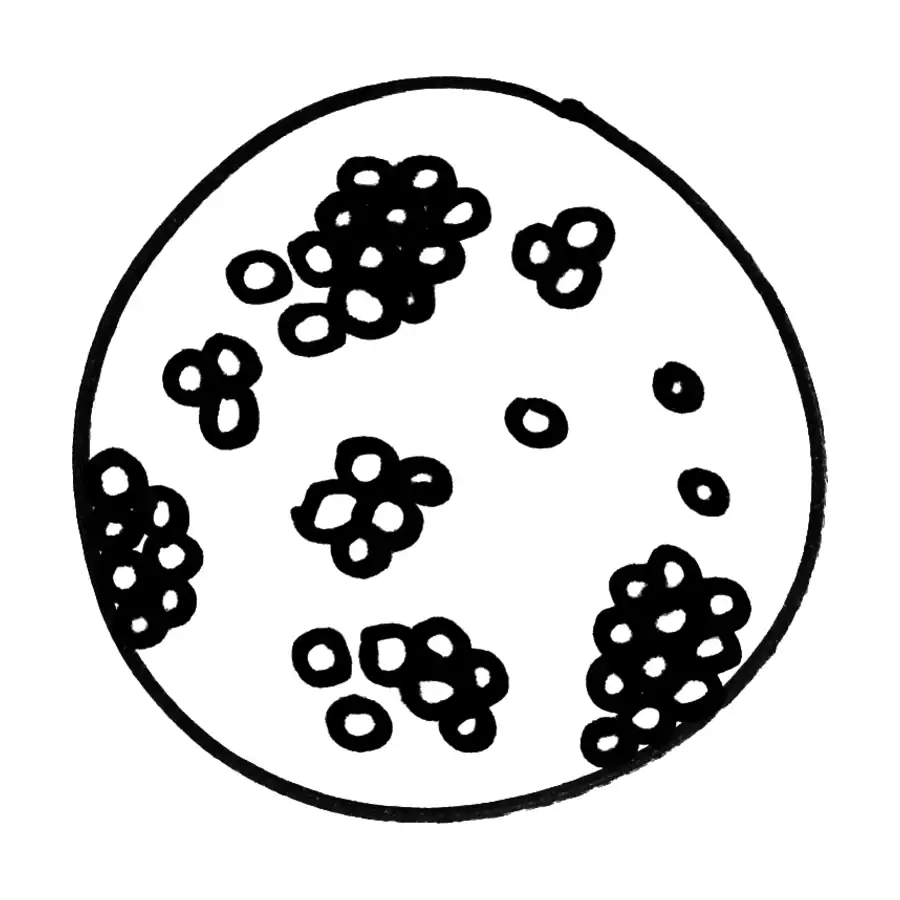 Croquis del concepto Hipótesis del Froot Loops